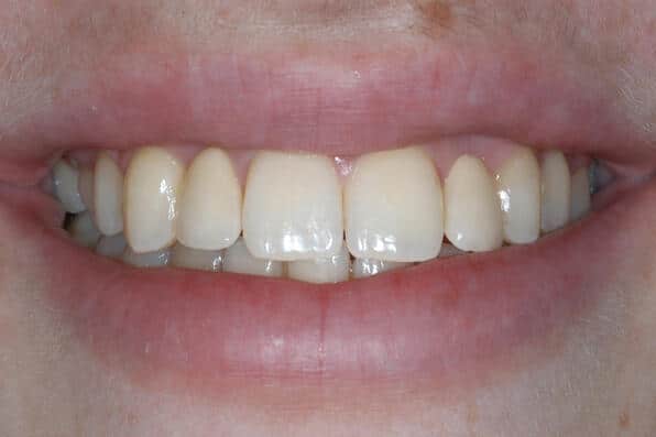 zahnarzt-luzern-ashaesivbruecken-3