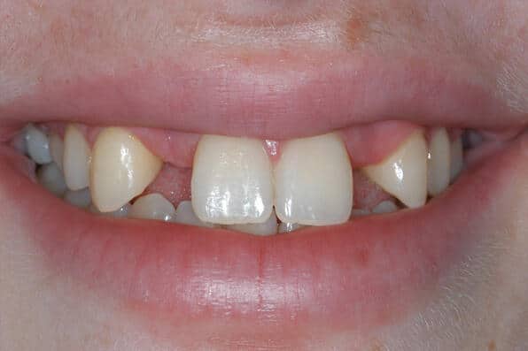 zahnarzt-luzern-ashaesivbruecken-4